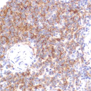 Immunohistochemistry (Formalin/PFA-fixed paraffin-embedded sections) - Anti-CD19 antibody [SP291] - C-terminal (AB227688)