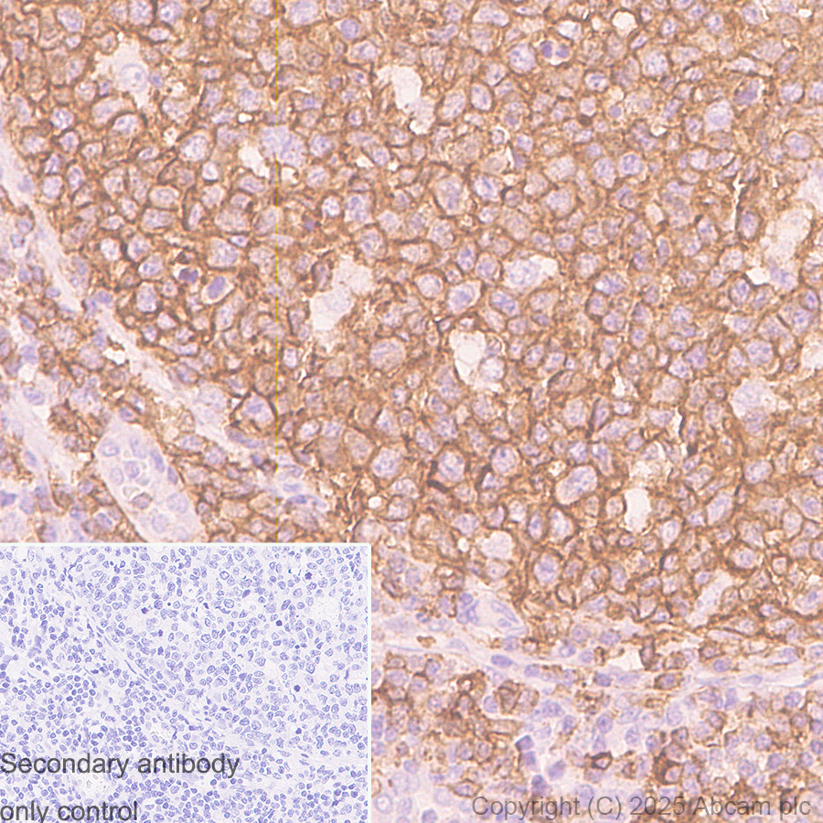 Anti-CD19 antibody - C-terminal [SP291] (ab227688) | Abcam
