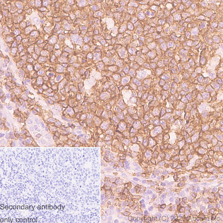 Immunohistochemistry (Formalin/PFA-fixed paraffin-embedded sections) - Anti-CD19 antibody [SP291] - C-terminal (AB227688)
