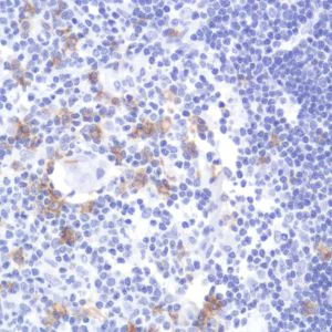 Immunohistochemistry (Formalin/PFA-fixed paraffin-embedded sections) - Anti-CD19 antibody [SP291] - C-terminal (AB227688)