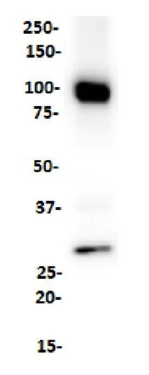Western blot - Anti-CD19 antibody [SP291] - C-terminal (AB227688)