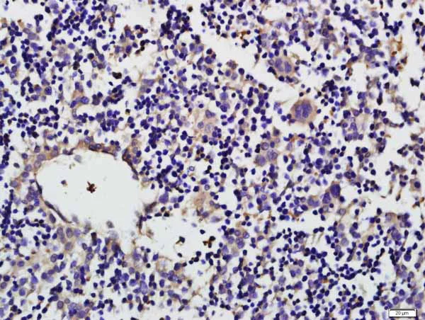 Immunohistochemistry (Formalin/PFA-fixed paraffin-embedded sections) - Anti-CD19 (phospho Y531) antibody (AB203615)