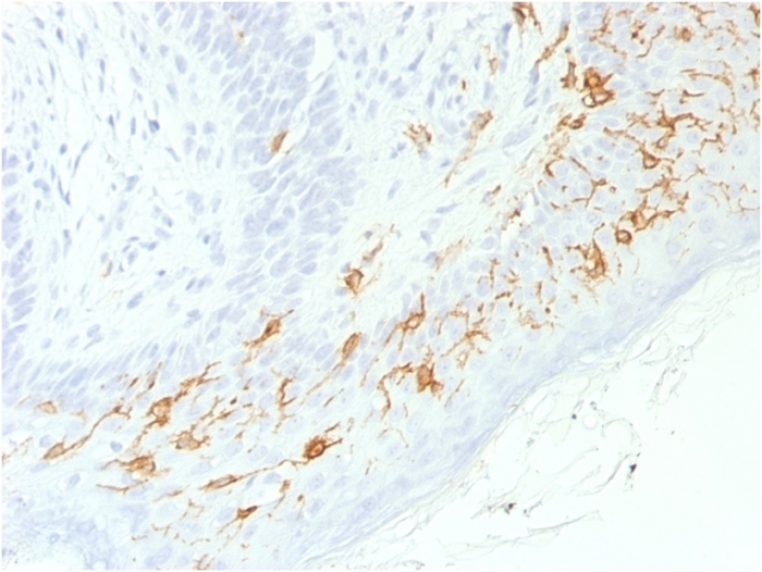 Immunohistochemistry (Formalin/PFA-fixed paraffin-embedded sections) - Anti-CD1a antibody [C1A/1506R] - BSA and Azide free (AB268266)
