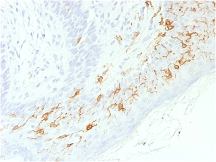 Immunohistochemistry (Formalin/PFA-fixed paraffin-embedded sections) - Anti-CD1a antibody [C1A/1506R] - BSA and Azide free (AB268266)