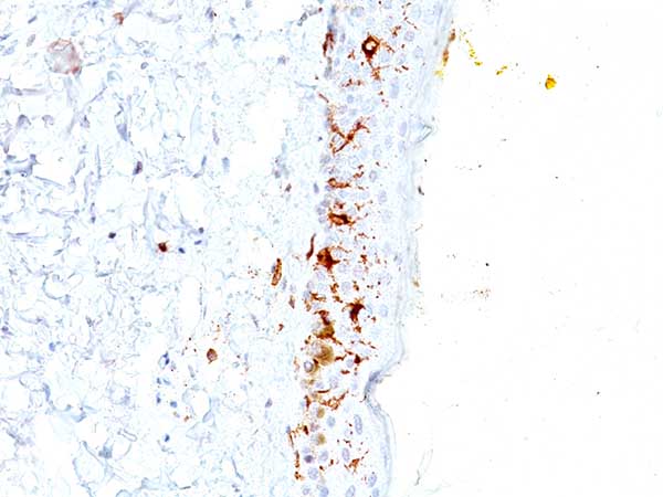 Immunohistochemistry (Formalin/PFA-fixed paraffin-embedded sections) - Anti-CD1a antibody [C1A/711] (AB201337)