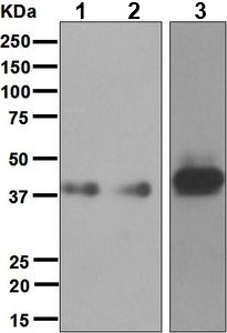 Western blot - Anti-CD1a antibody [EP3091] (AB76531)