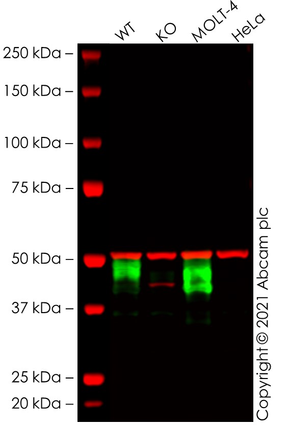 Western blot - Anti-CD1a antibody [EP3091] (AB76531)