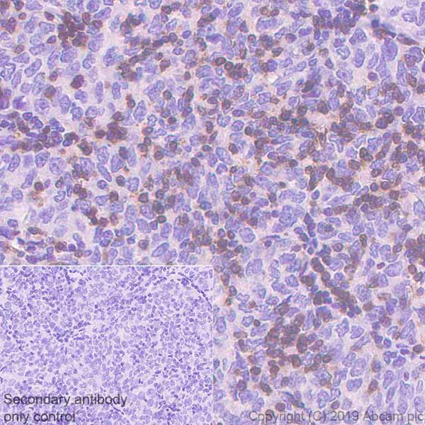 Immunohistochemistry (Formalin/PFA-fixed paraffin-embedded sections) - Anti-CD1a antibody [EP3622] (AB108309)