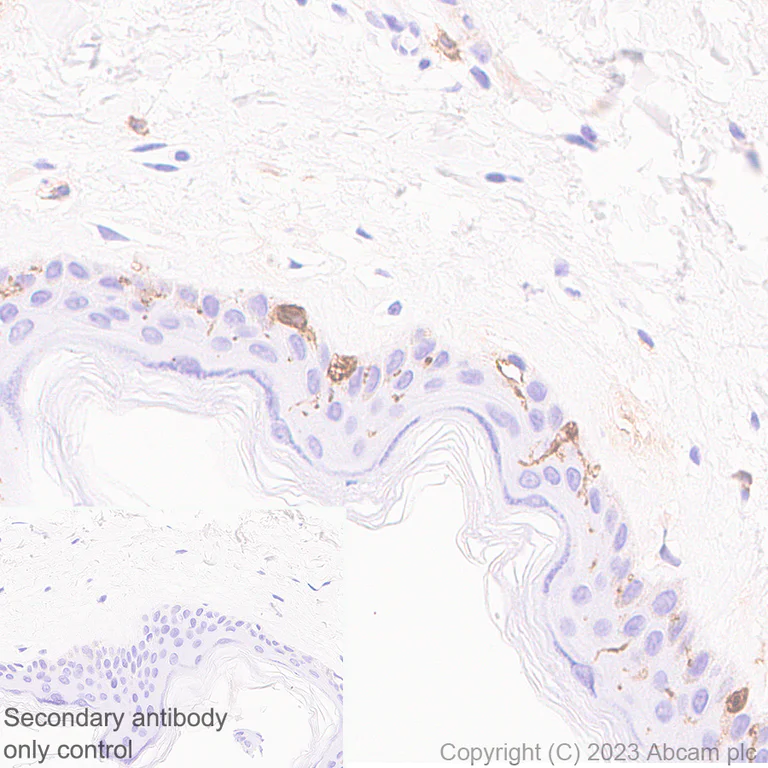 Immunohistochemistry (Formalin/PFA-fixed paraffin-embedded sections) - Anti-CD1a antibody [EPR26526-62] (AB313875)