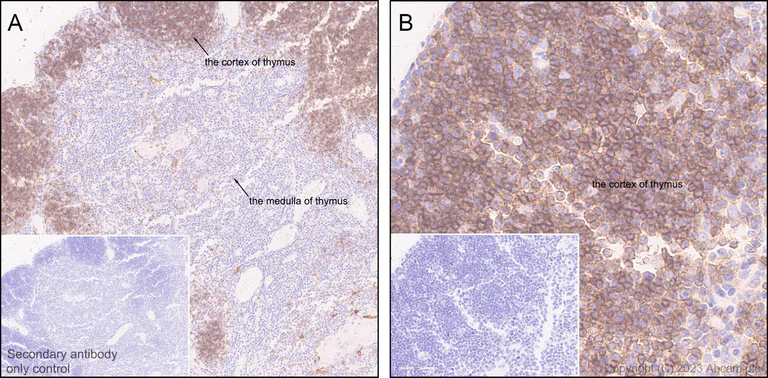Immunohistochemistry (Formalin/PFA-fixed paraffin-embedded sections) - Anti-CD1a antibody [EPR26526-62] (AB313875)