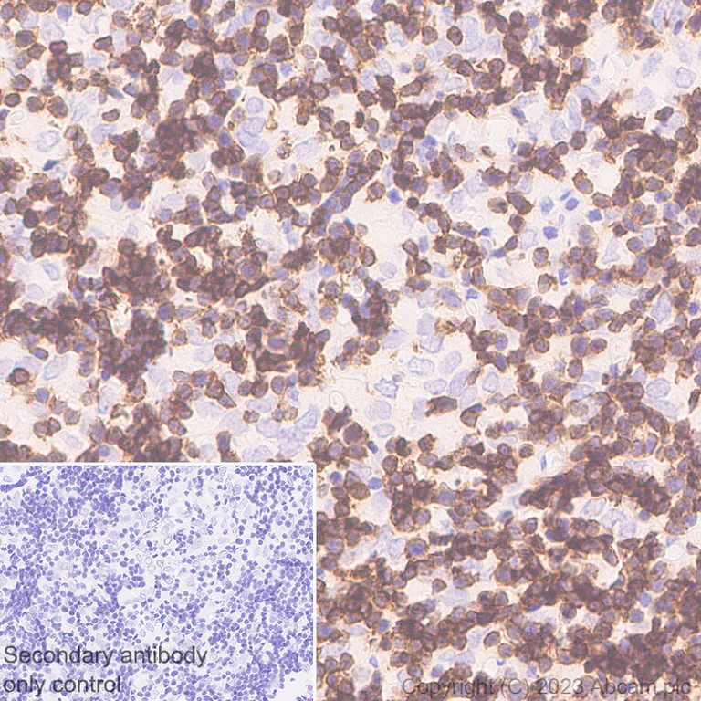 Immunohistochemistry (Formalin/PFA-fixed paraffin-embedded sections) - Anti-CD1a antibody [EPR26526-62] (AB313875)