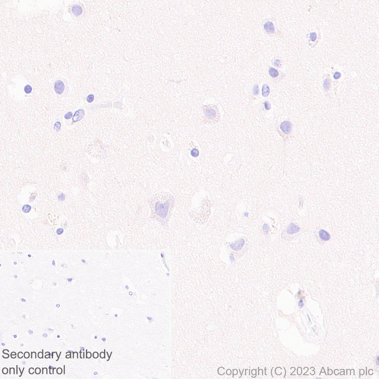 Immunohistochemistry (Formalin/PFA-fixed paraffin-embedded sections) - Anti-CD1a antibody [EPR26526-62] (AB313875)