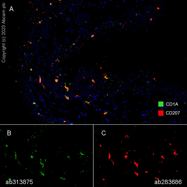 Multiplex immunohistochemistry - Anti-CD1a antibody [EPR26526-62] (AB313875)