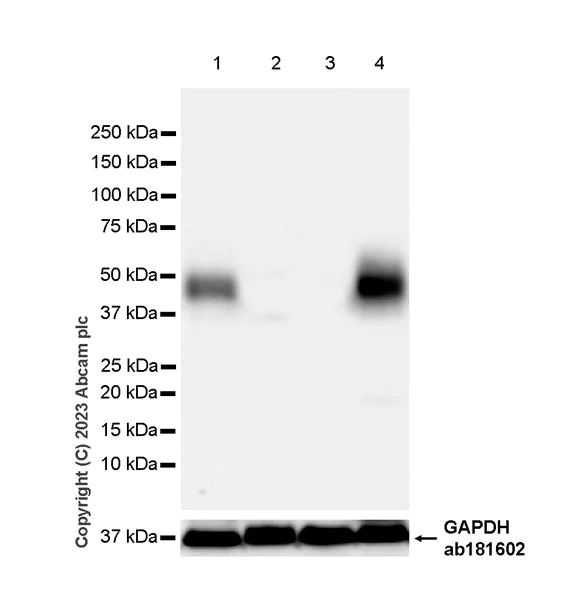 Western blot - Anti-CD1a antibody [EPR26526-62] (AB313875)