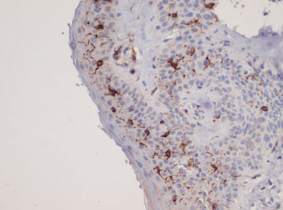 Immunohistochemistry (Formalin/PFA-fixed paraffin-embedded sections) - Anti-CD1a antibody [L21-A] (AB136922)