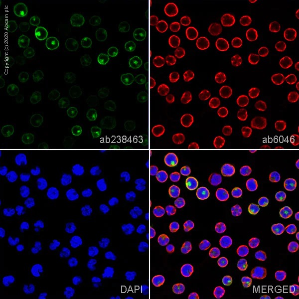 Immunocytochemistry/ Immunofluorescence - Anti-CD1a antibody [NA1/34] (AB238463)