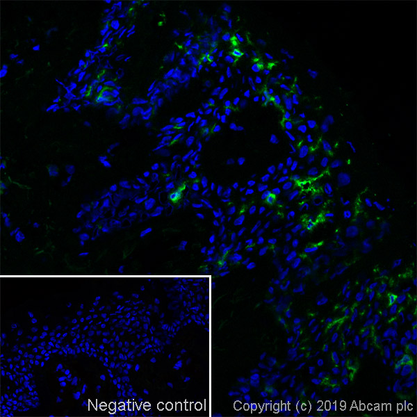 Immunohistochemistry (Frozen sections) - Anti-CD1a antibody [NA1/34] - BSA and Azide free (AB244579)