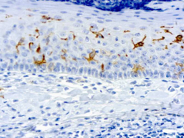 Immunohistochemistry (Formalin/PFA-fixed paraffin-embedded sections) - Anti-CD1a antibody [O10] (AB17186)