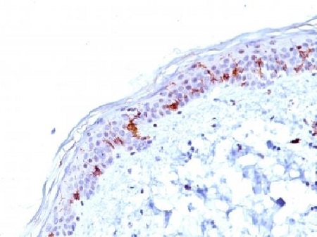 Immunohistochemistry (Formalin/PFA-fixed paraffin-embedded sections) - Anti-CD1a antibody [O10] (AB233990)