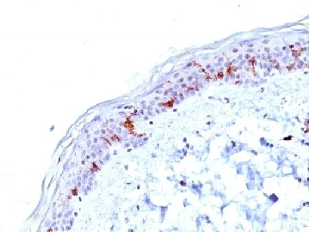 Immunohistochemistry (Formalin/PFA-fixed paraffin-embedded sections) - Anti-CD1a antibody [O10] - BSA and Azide free (AB212980)