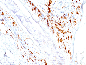 Immunohistochemistry (Formalin/PFA-fixed paraffin-embedded sections) - Anti-CD1a antibody [O10+C1A/711] (AB200700), expandable thumbnail