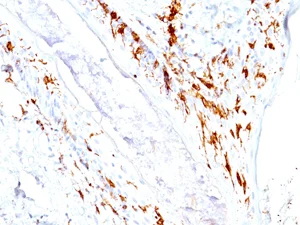 Immunohistochemistry (Formalin/PFA-fixed paraffin-embedded sections) - Anti-CD1a antibody [O10+C1A/711] (AB200700)