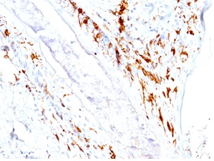 Immunohistochemistry (Formalin/PFA-fixed paraffin-embedded sections) - Anti-CD1a antibody [O10+C1A/711] - BSA and Azide free (AB212983)