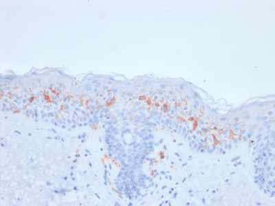 Immunohistochemistry (Formalin/PFA-fixed paraffin-embedded sections) - Anti-CD1a antibody [rC1A/711] (AB238082)