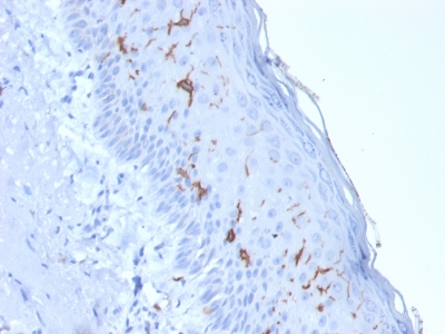 Immunohistochemistry (Formalin/PFA-fixed paraffin-embedded sections) - Anti-CD1a antibody [rC1A/711] (AB238082)
