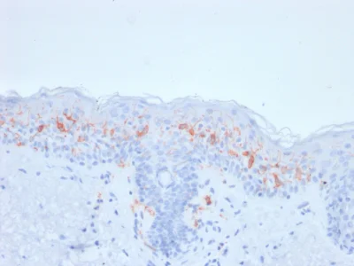 Immunohistochemistry (Formalin/PFA-fixed paraffin-embedded sections) - Anti-CD1a antibody [rC1A/711] - BSA and Azide free (AB237936)