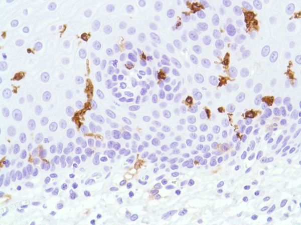 Immunohistochemistry (Formalin/PFA-fixed paraffin-embedded sections) - Anti-CD1a antibody [SP157] (AB231440), expandable thumbnail