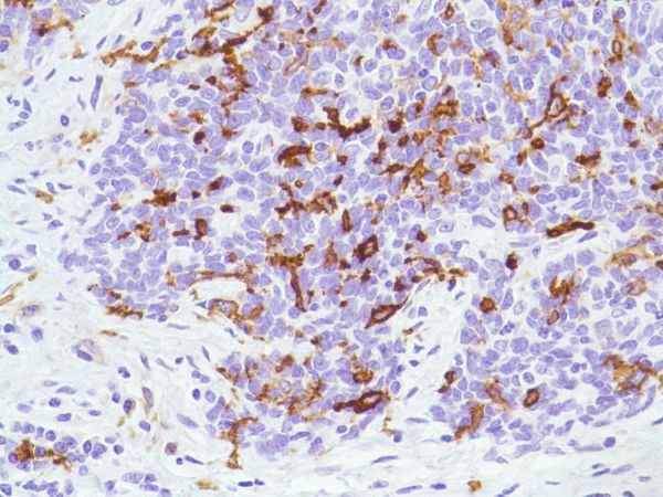 Immunohistochemistry (Formalin/PFA-fixed paraffin-embedded sections) - Anti-CD1a antibody [SP157] (ab231440), expandable thumbnail