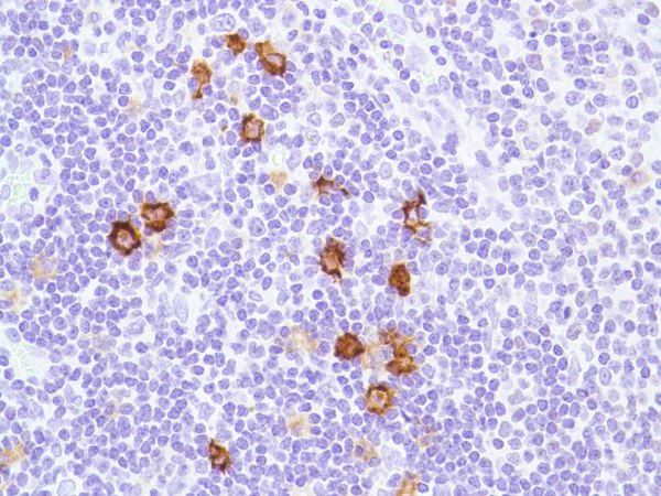 Immunohistochemistry (Formalin/PFA-fixed paraffin-embedded sections) - Anti-CD1a antibody [SP157] (AB231440)