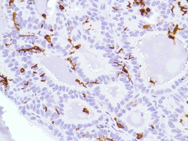 Immunohistochemistry (Formalin/PFA-fixed paraffin-embedded sections) - Anti-CD1a antibody [SP157] (ab231440), expandable thumbnail