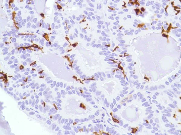Immunohistochemistry (Formalin/PFA-fixed paraffin-embedded sections) - Anti-CD1a antibody [SP157] (AB231440)