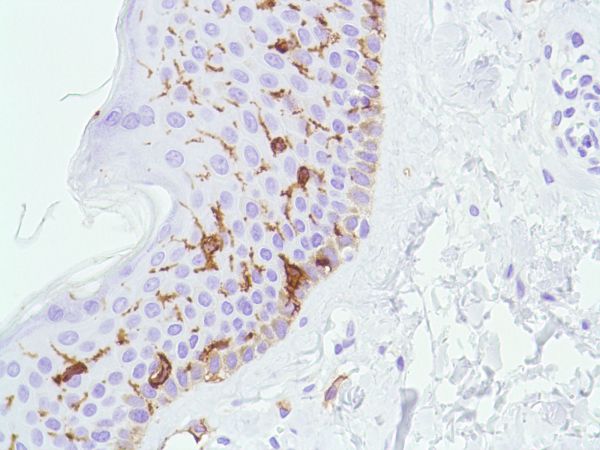 Immunohistochemistry (Formalin/PFA-fixed paraffin-embedded sections) - Anti-CD1a antibody [SP157] (AB231440), expandable thumbnail