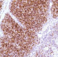 Immunohistochemistry (Formalin/PFA-fixed paraffin-embedded sections) - Anti-CD1a antibody [SP157] (AB231440), expandable thumbnail