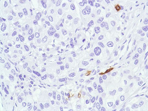 Immunohistochemistry (Formalin/PFA-fixed paraffin-embedded sections) - Anti-CD1a antibody [SP157] (ab231440), expandable thumbnail