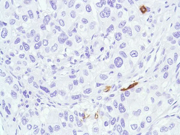 Immunohistochemistry (Formalin/PFA-fixed paraffin-embedded sections) - Anti-CD1a antibody [SP157] (AB231440)