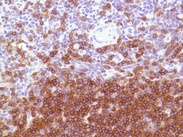 Immunohistochemistry (Formalin/PFA-fixed paraffin-embedded sections) - Anti-CD1a antibody [SP157] (AB231440), expandable thumbnail