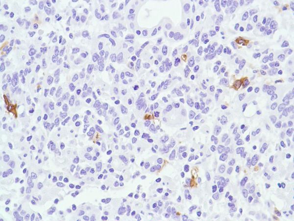 Immunohistochemistry (Formalin/PFA-fixed paraffin-embedded sections) - Anti-CD1a antibody [SP157] (ab231440), expandable thumbnail