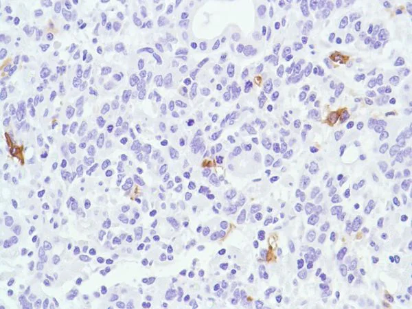 Immunohistochemistry (Formalin/PFA-fixed paraffin-embedded sections) - Anti-CD1a antibody [SP157] (AB231440)