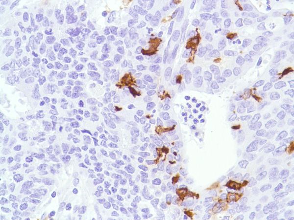 Immunohistochemistry (Formalin/PFA-fixed paraffin-embedded sections) - Anti-CD1a antibody [SP157] (ab231440), expandable thumbnail