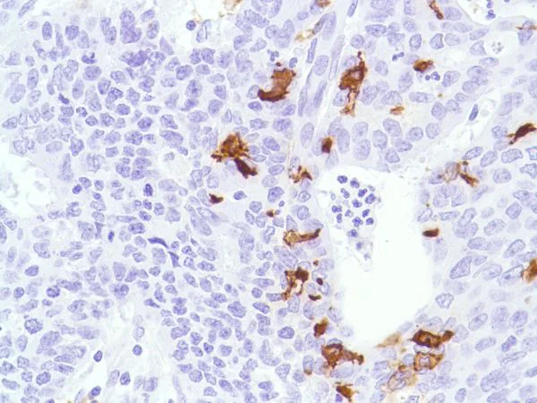 Immunohistochemistry (Formalin/PFA-fixed paraffin-embedded sections) - Anti-CD1a antibody [SP157] (AB231440)