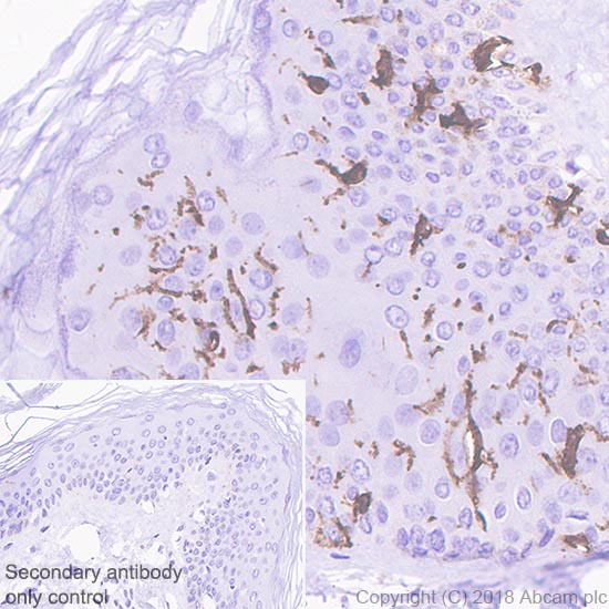 Immunohistochemistry (Formalin/PFA-fixed paraffin-embedded sections) - Anti-CD1a antibody [SP157] (AB231440), expandable thumbnail