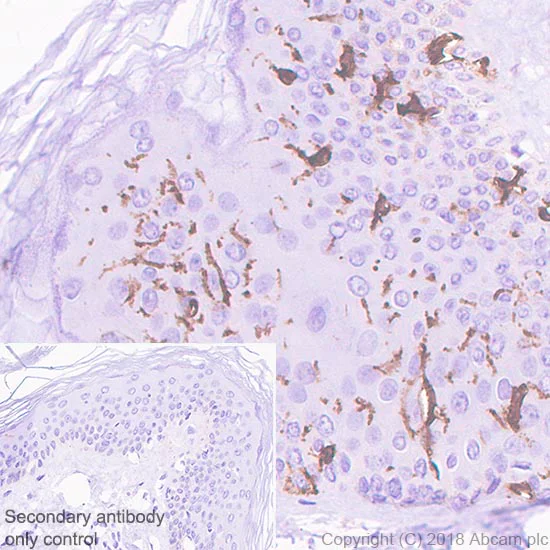 Immunohistochemistry (Formalin/PFA-fixed paraffin-embedded sections) - Anti-CD1a antibody [SP157] - BSA and Azide free (AB240411)