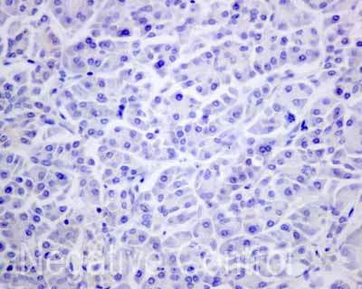 Immunohistochemistry (Formalin/PFA-fixed paraffin-embedded sections) - Anti-CD1b antibody [EP7251] (AB173576)