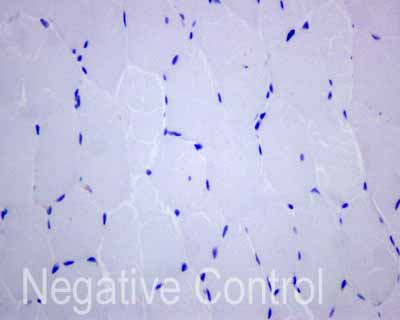 Immunohistochemistry (Formalin/PFA-fixed paraffin-embedded sections) - Anti-CD1b antibody [EP7251] (AB173576), expandable thumbnail