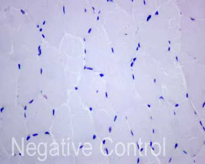 Immunohistochemistry (Formalin/PFA-fixed paraffin-embedded sections) - Anti-CD1b antibody [EP7251] (AB173576)