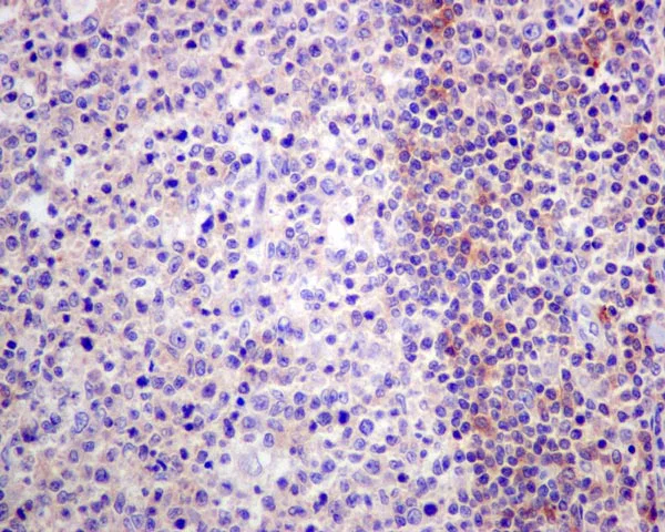 Immunohistochemistry (Formalin/PFA-fixed paraffin-embedded sections) - Anti-CD1b antibody [EP7251] (AB173576)